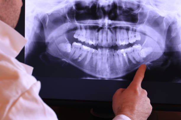 Best Emergency Treatment for Dental Infections or Abscesses in Montague, CA